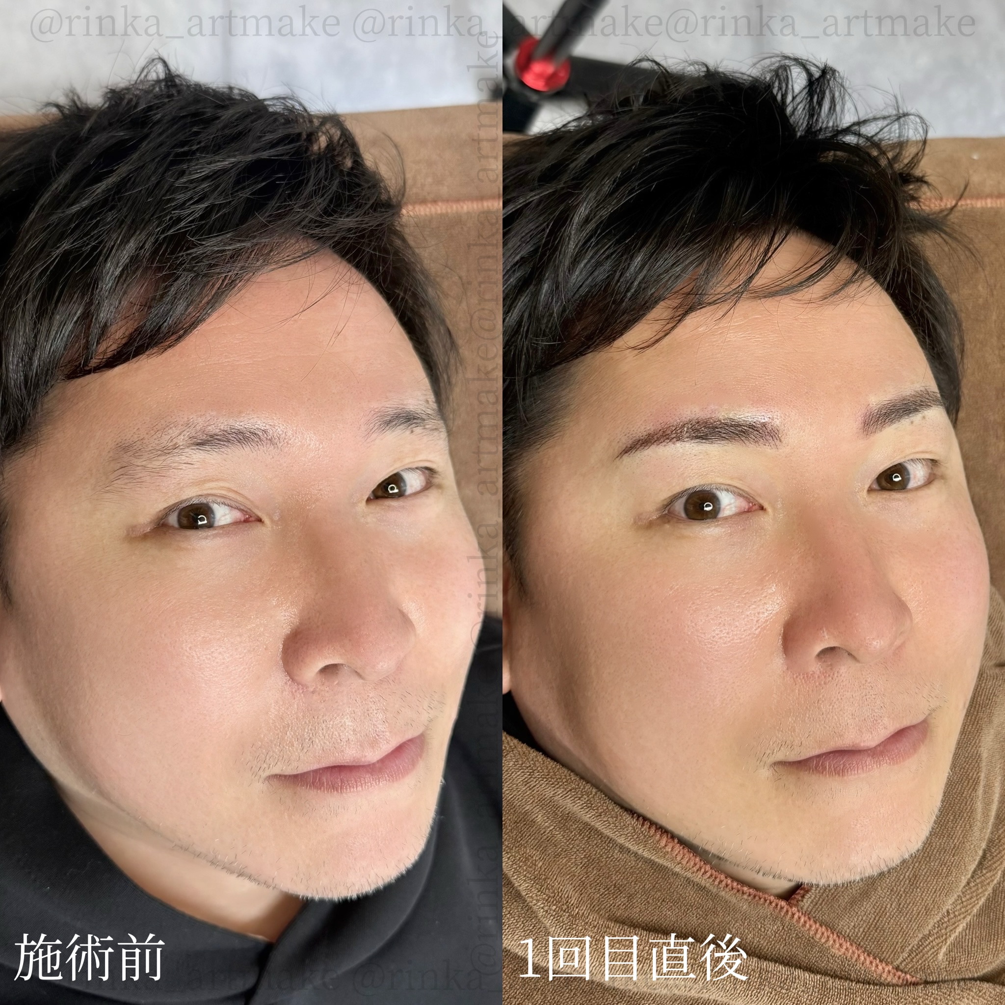 症例4